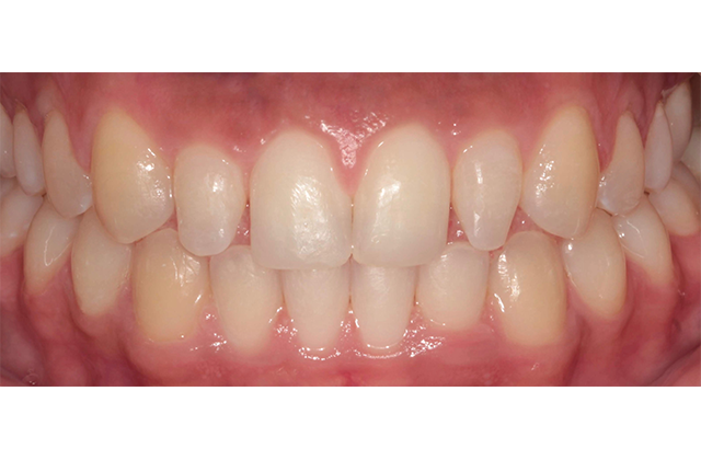 Before