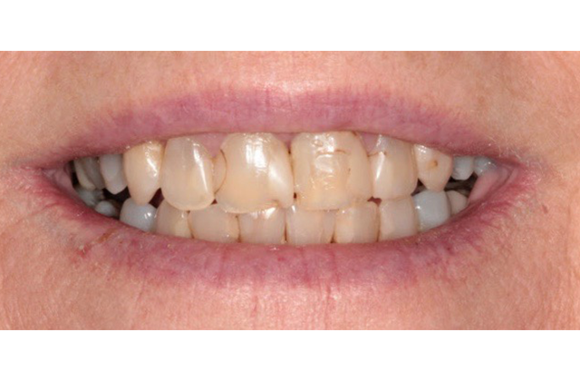Before