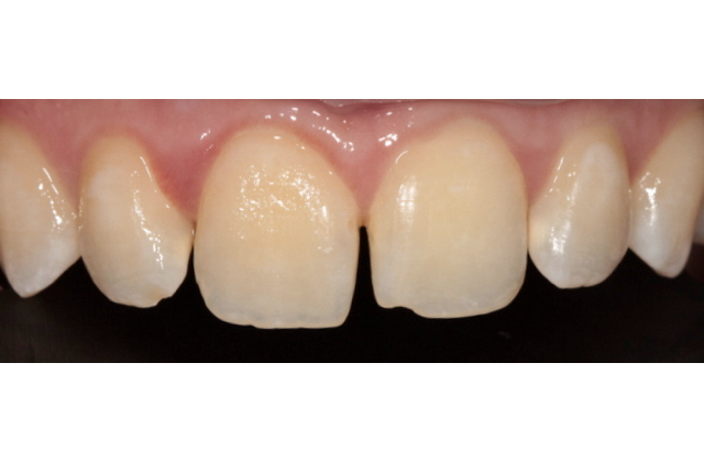Before