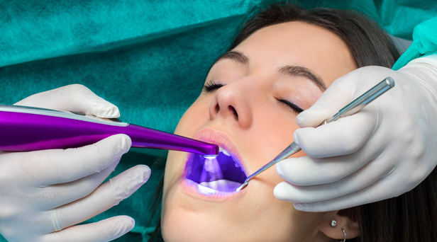 What Are Dental Sealants
