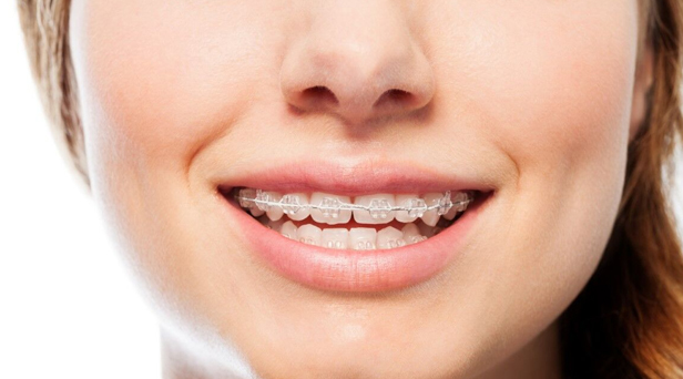 What Are Six Month Smiles 1