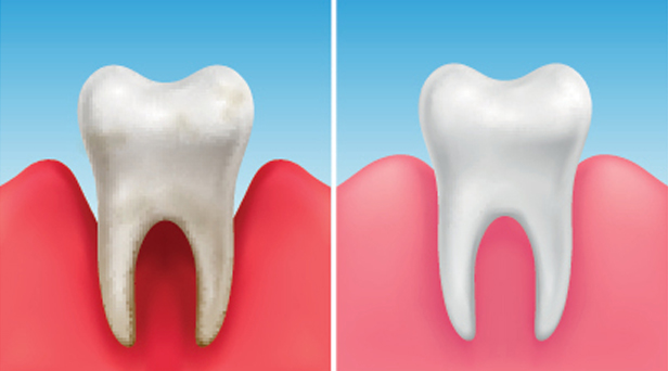 What Is Periodontics