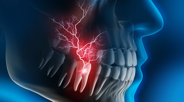 Why Choose Dr. Bassiri For Your Emergency Dental Care