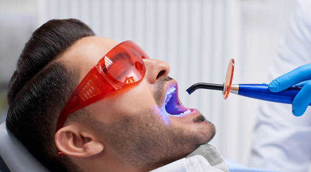 Why Would You Need Composite Fillings