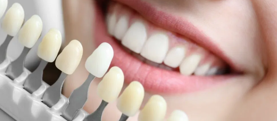 Dental Color, Everything We Need To Know And Its Relationship With Dental Aesthetics