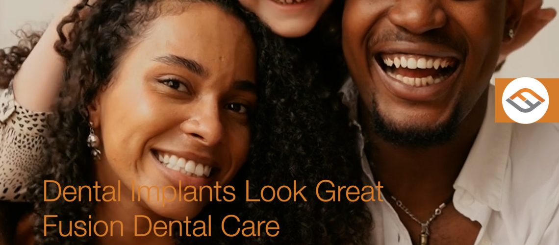 fusion fb dental implants 03.00 00 06 04.still022